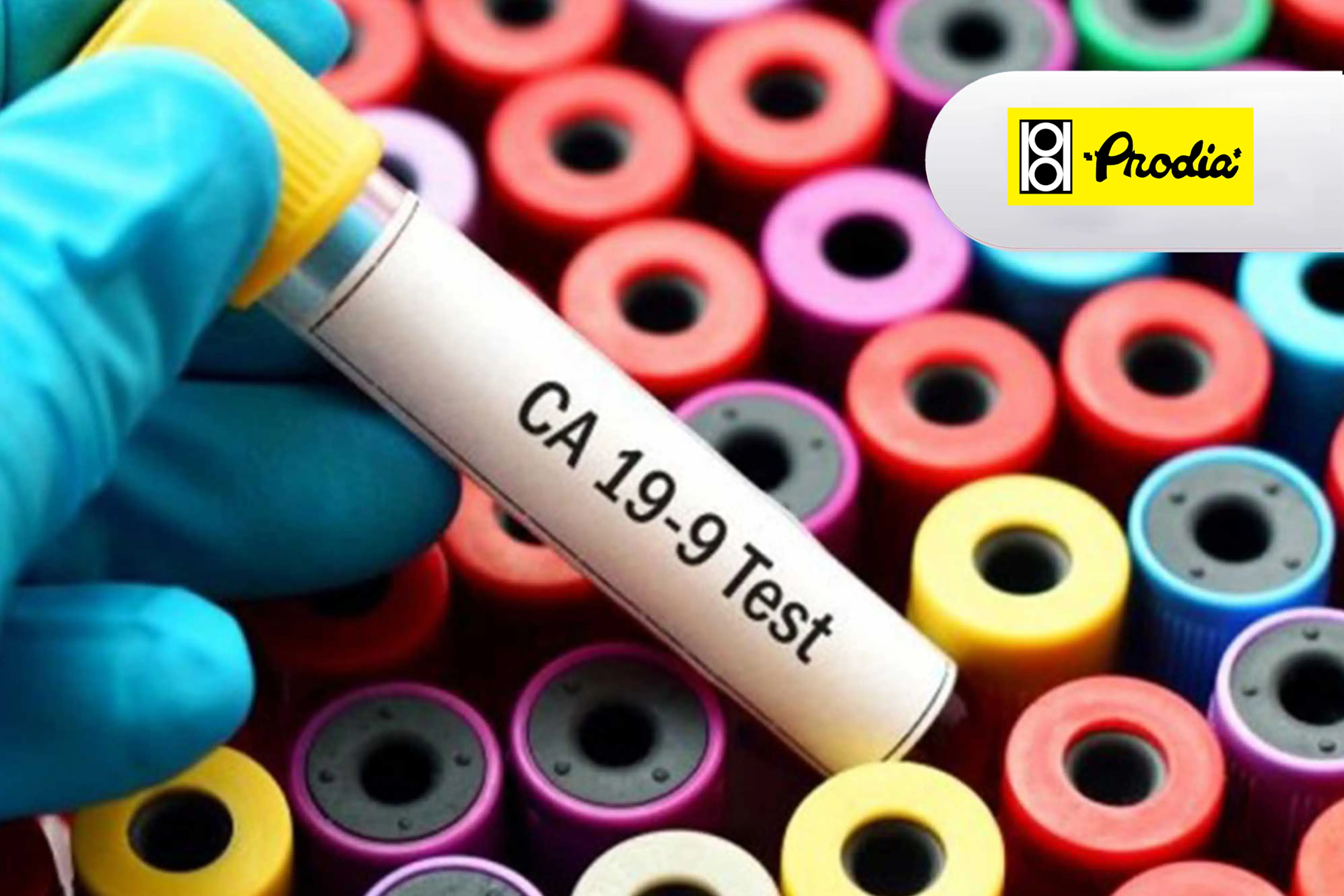 CA19-9